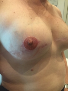 areola-tattooing-17