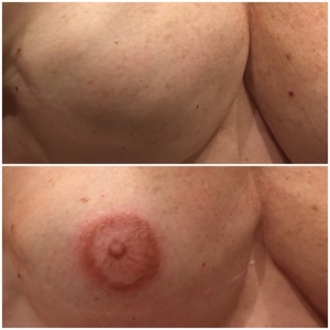 areola-tattooing-3