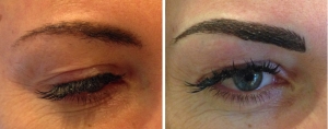 before-after-combination-brow-1