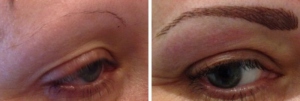 before-after-combination-brow-10