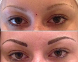 before-after-combination-brow-14