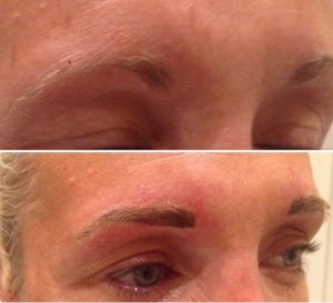 before-after-combination-brow-18