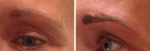 before-after-combination-brow-19