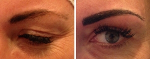 before-after-combination-brow-2
