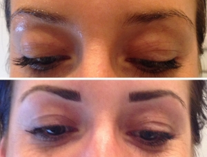 before-after-combination-brow-4