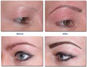 combination-brow-1