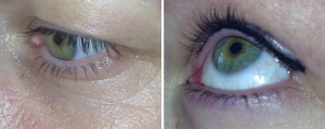before-after-eye-liner