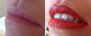 before-after-lip-colour