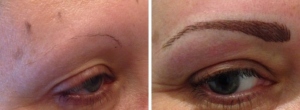 before-after-hairstroke-7